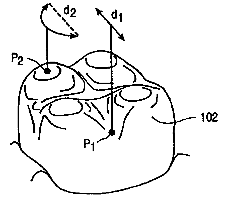 Systems and methods for positioning teeth
