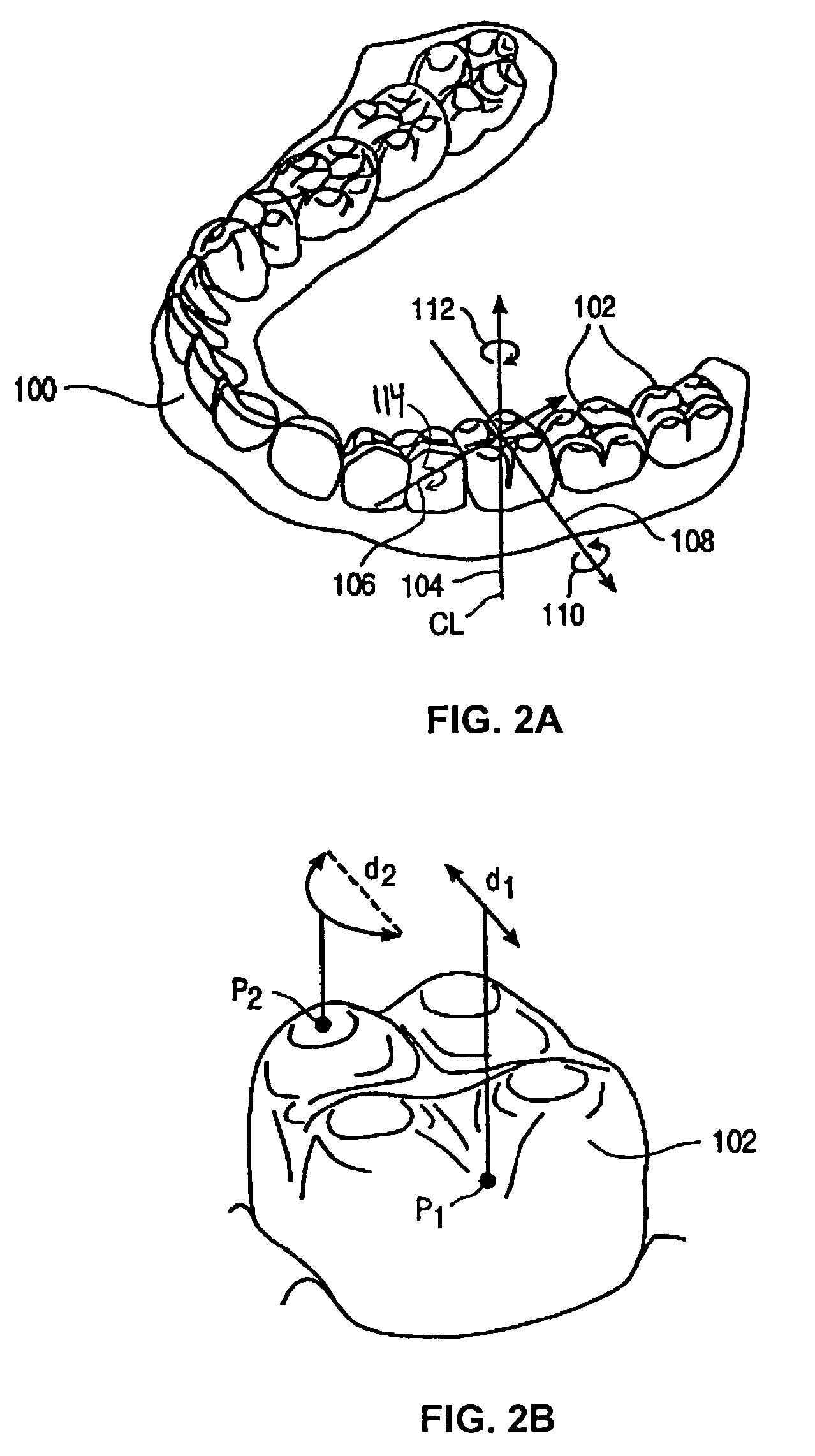Systems and methods for positioning teeth