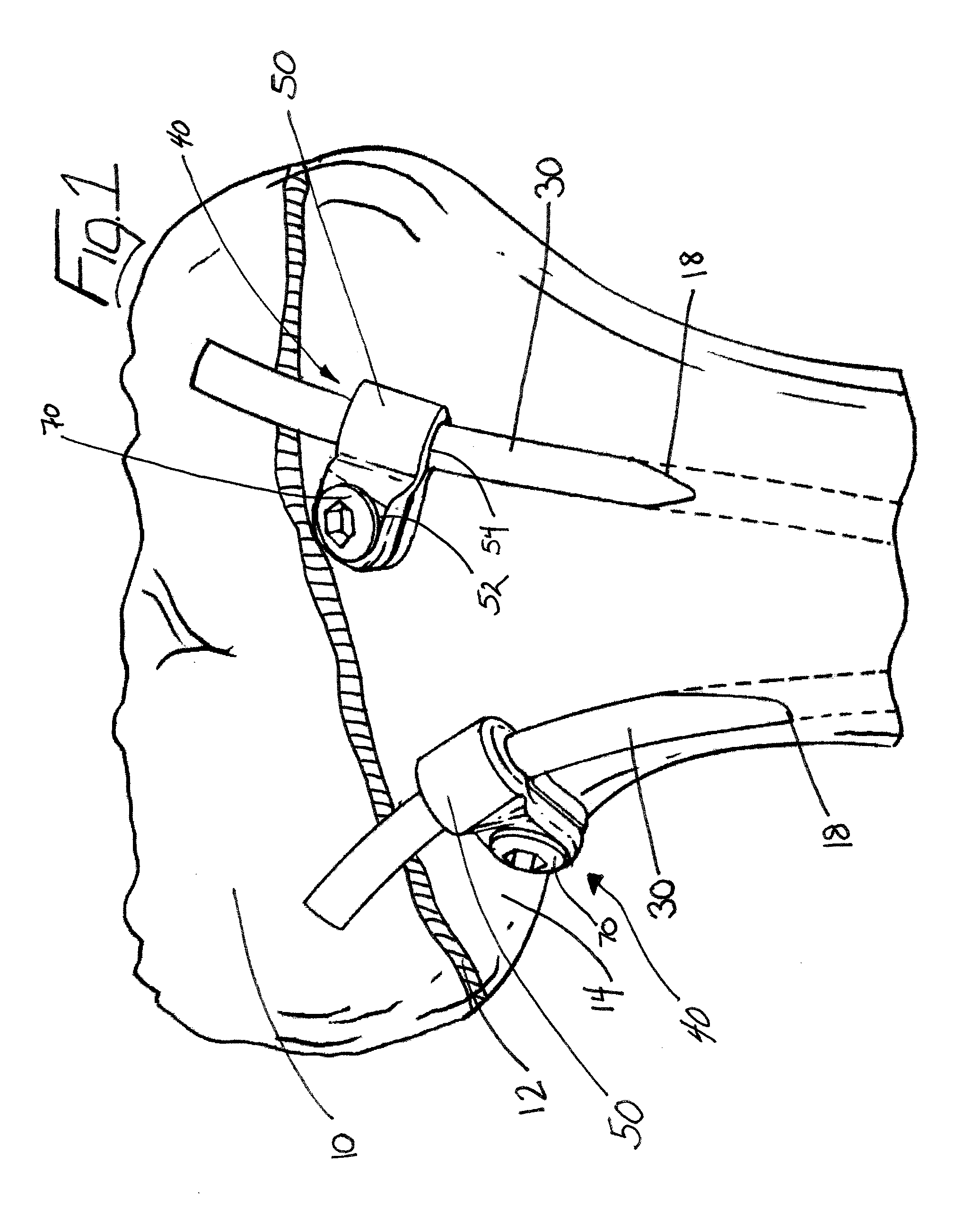 Clamp For A Medical Implant And A Method For Using The Same