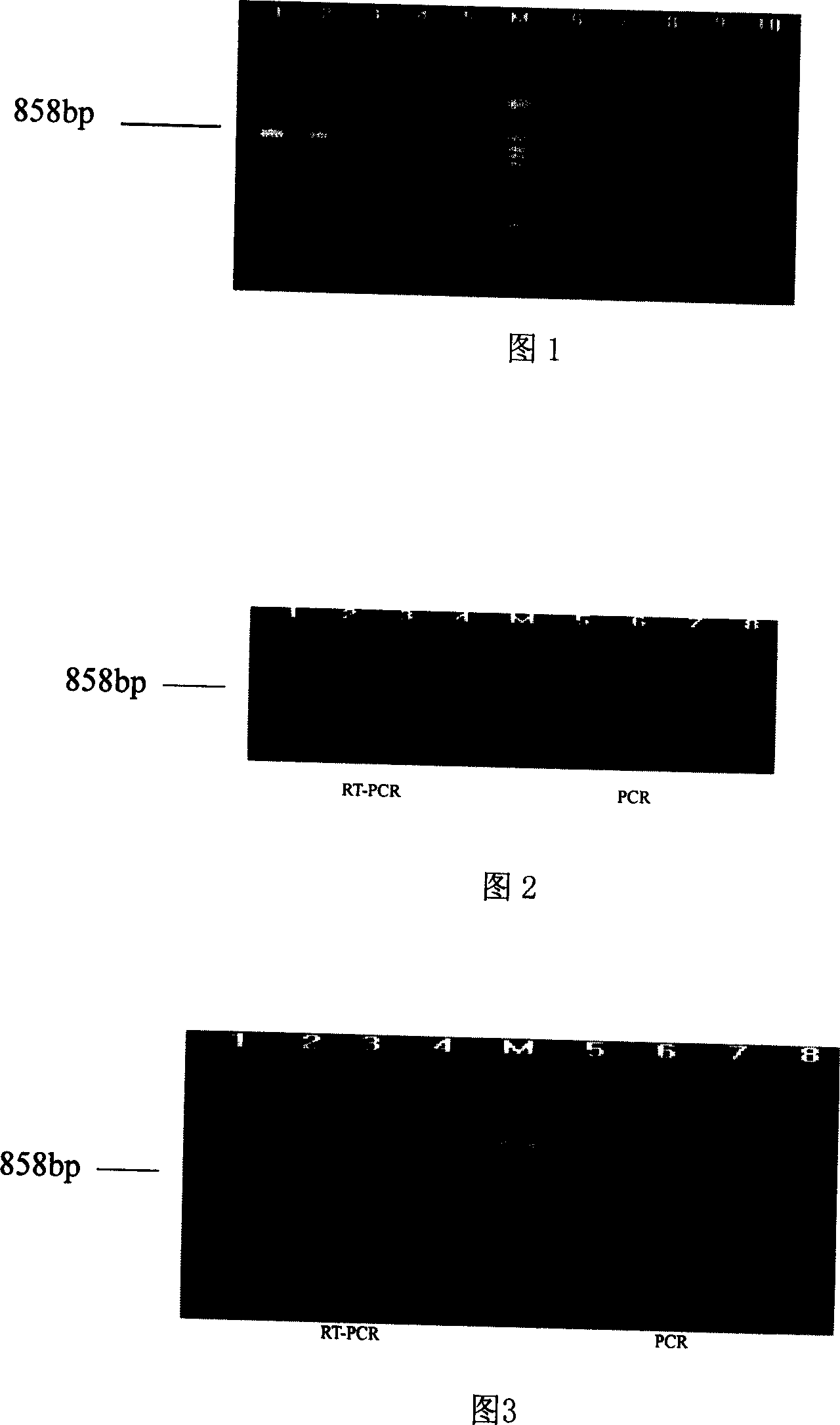 Reagent kit for inspecting active mononucleosis Lee's bacterium RT-PCR and its inspection