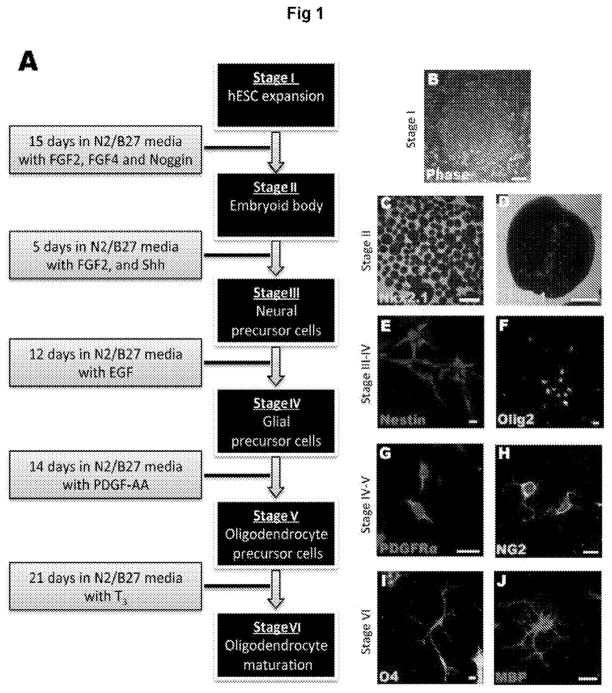 Oligodendroglial cell culturing methods and in methods for treating neurodegenerative disorders by using thyroid hormones or analogues