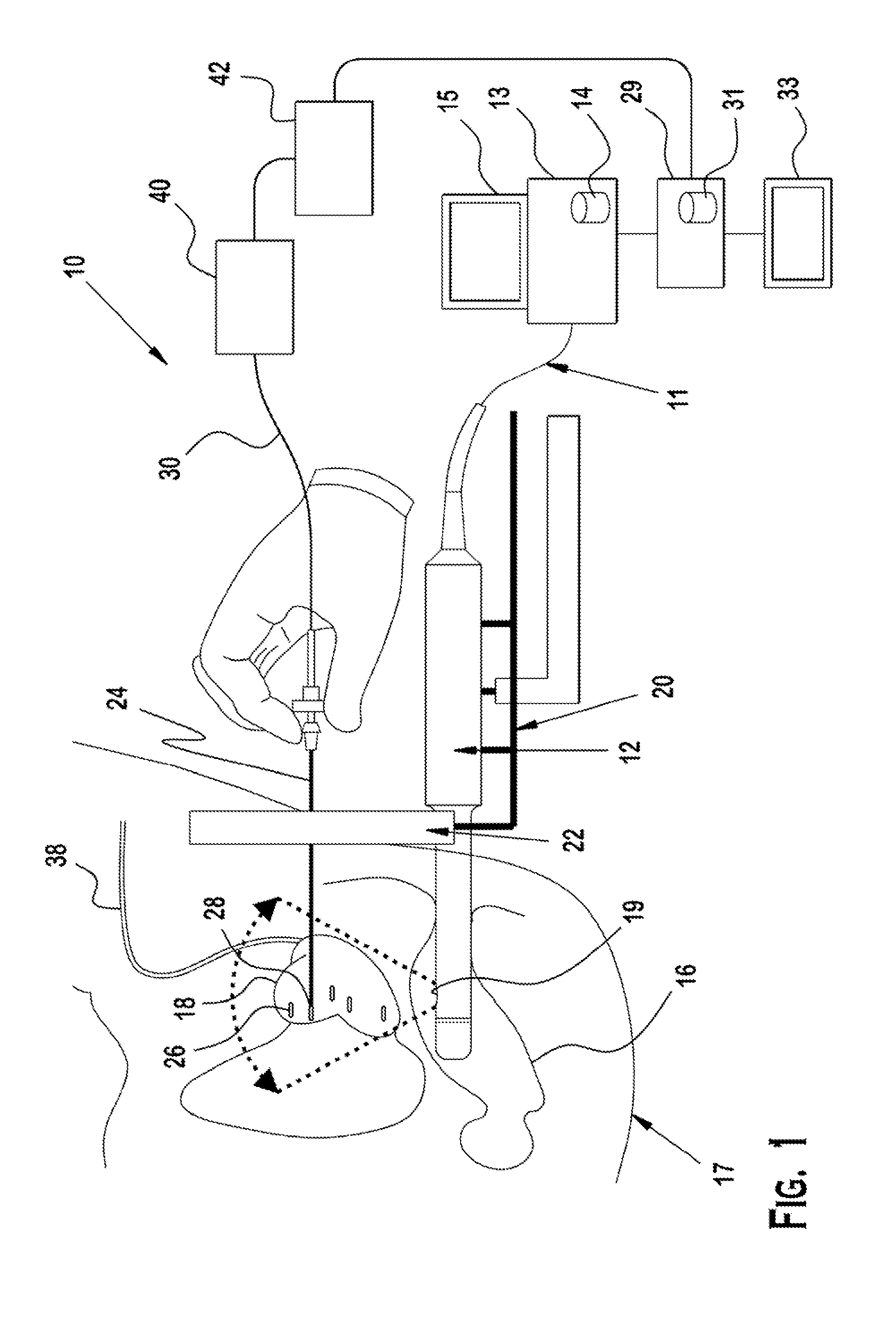 Interventional photoacoustic imaging system