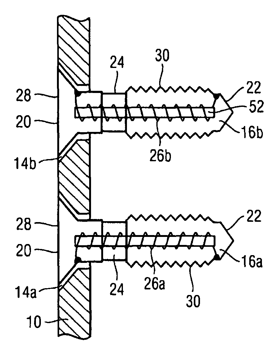 Implantable device, system for generating localised electromagnetic fields in the area of an implant and coil arrangement
