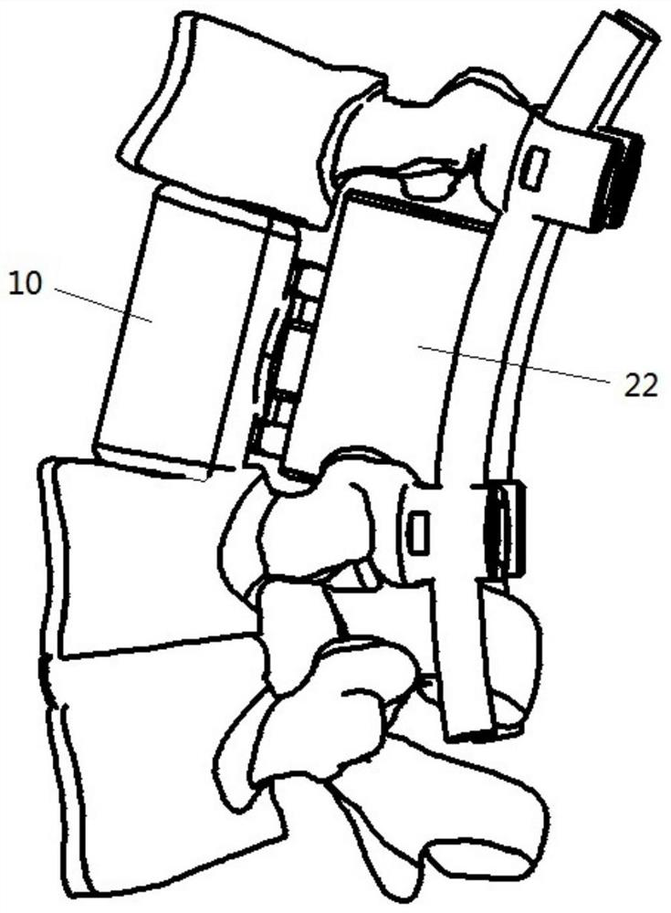 Vertebral prosthesis