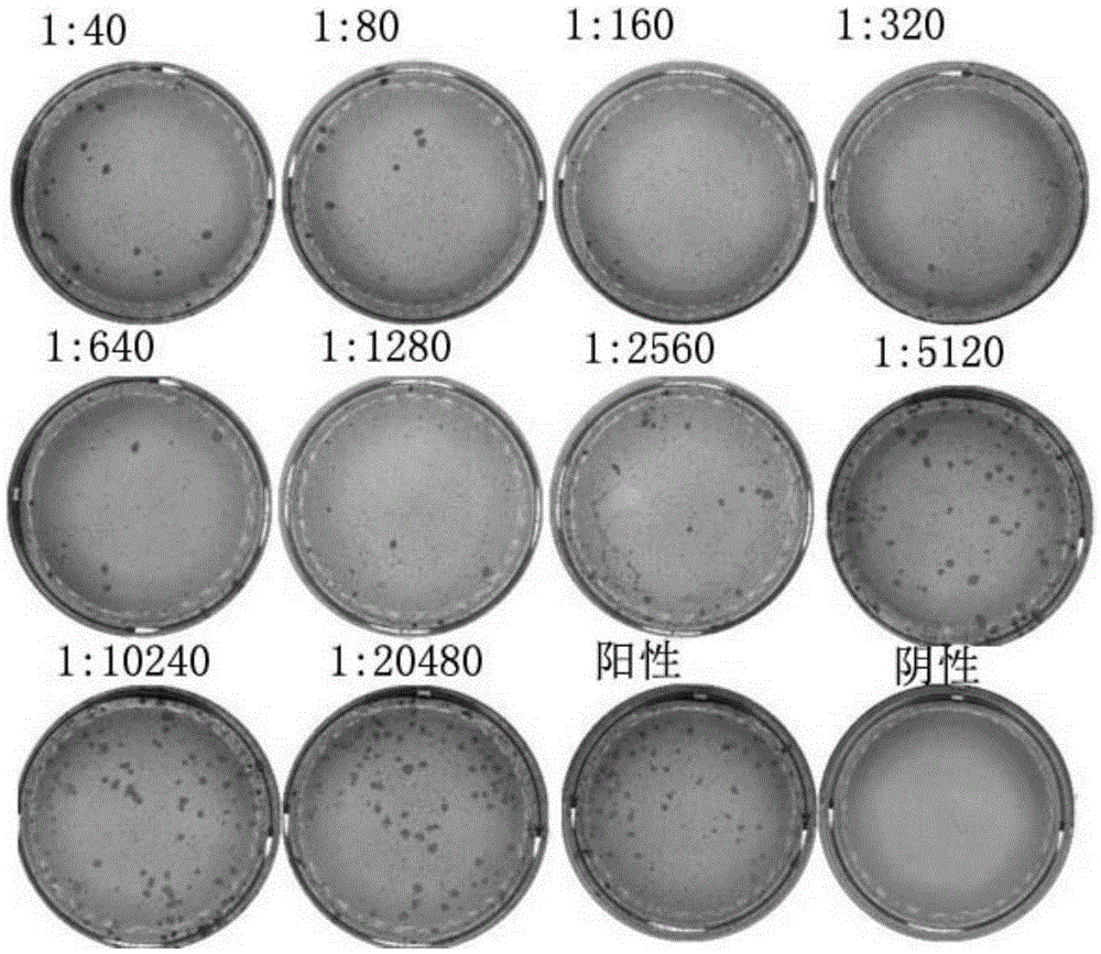 Neutralizing epitope from varicella-zoster virus (VZV) gE protein and antibody aiming the same