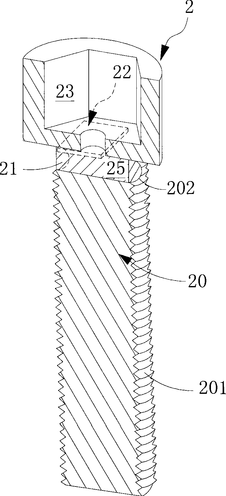 Fixing element and detection system thereof