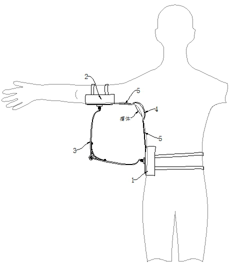 Subcutaneous tumor removing device