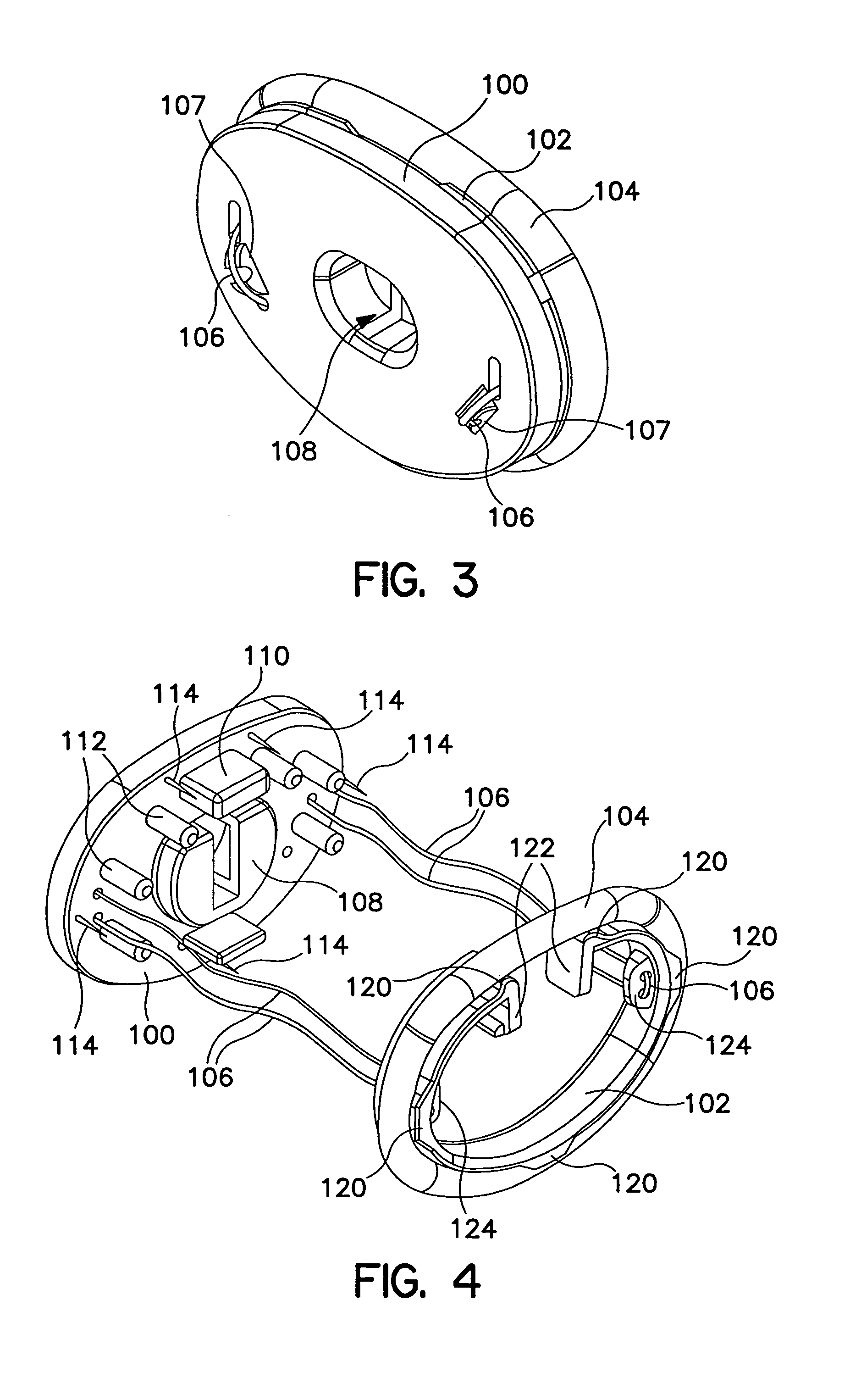 Annuloplasty system