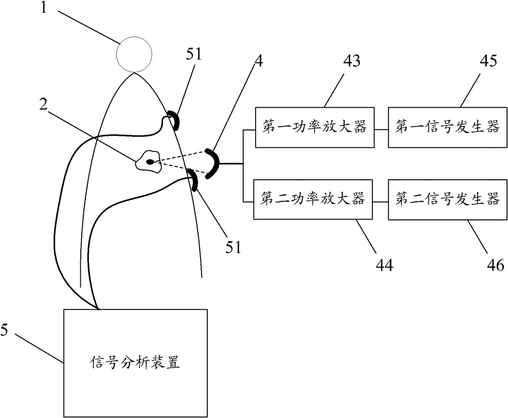 Double-frequency focused ultrasound system