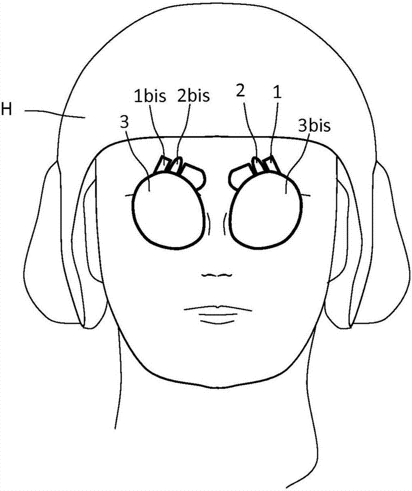 Head-borne viewing system comprising crossed optics