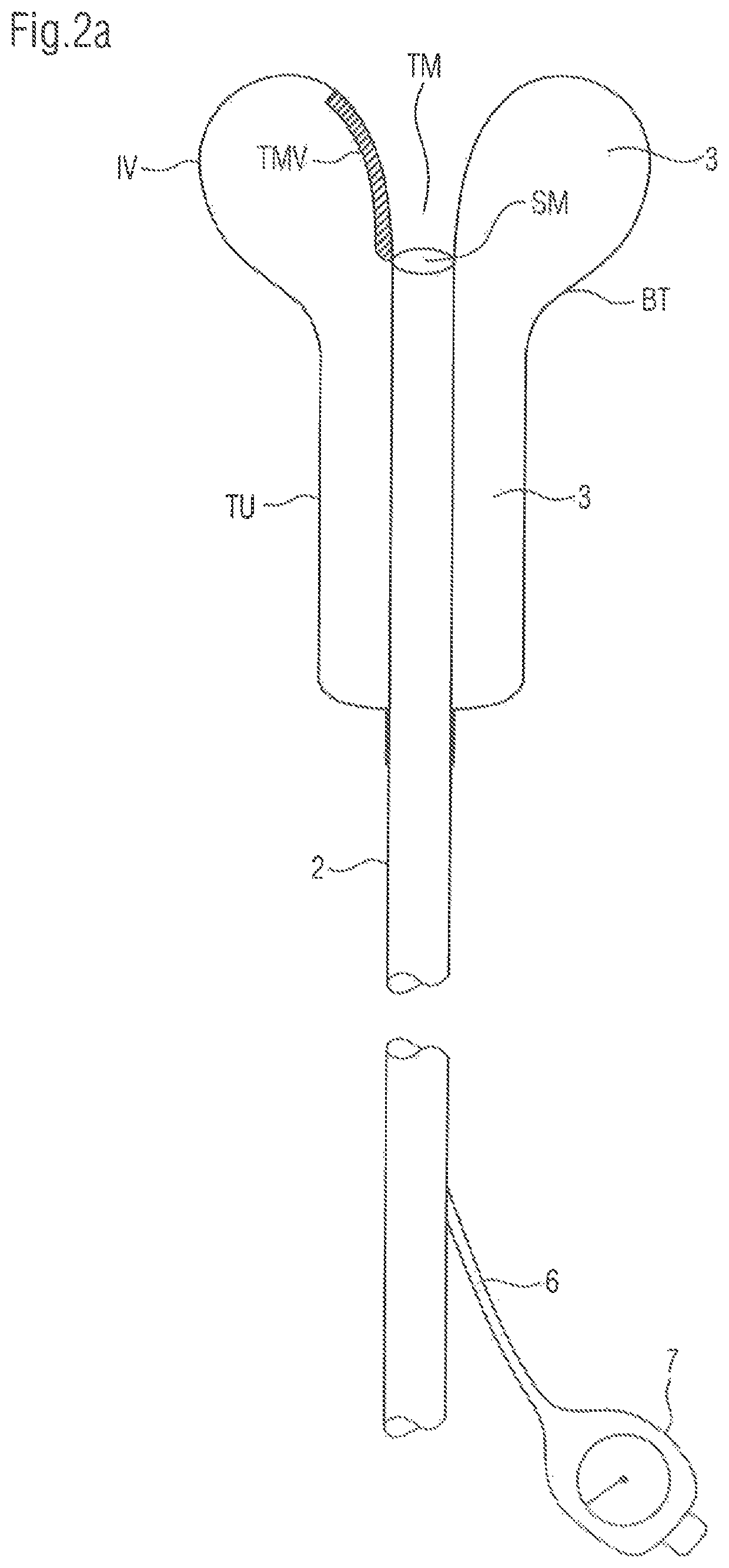 Bladder catheter for the minimally invasive discharge of urine