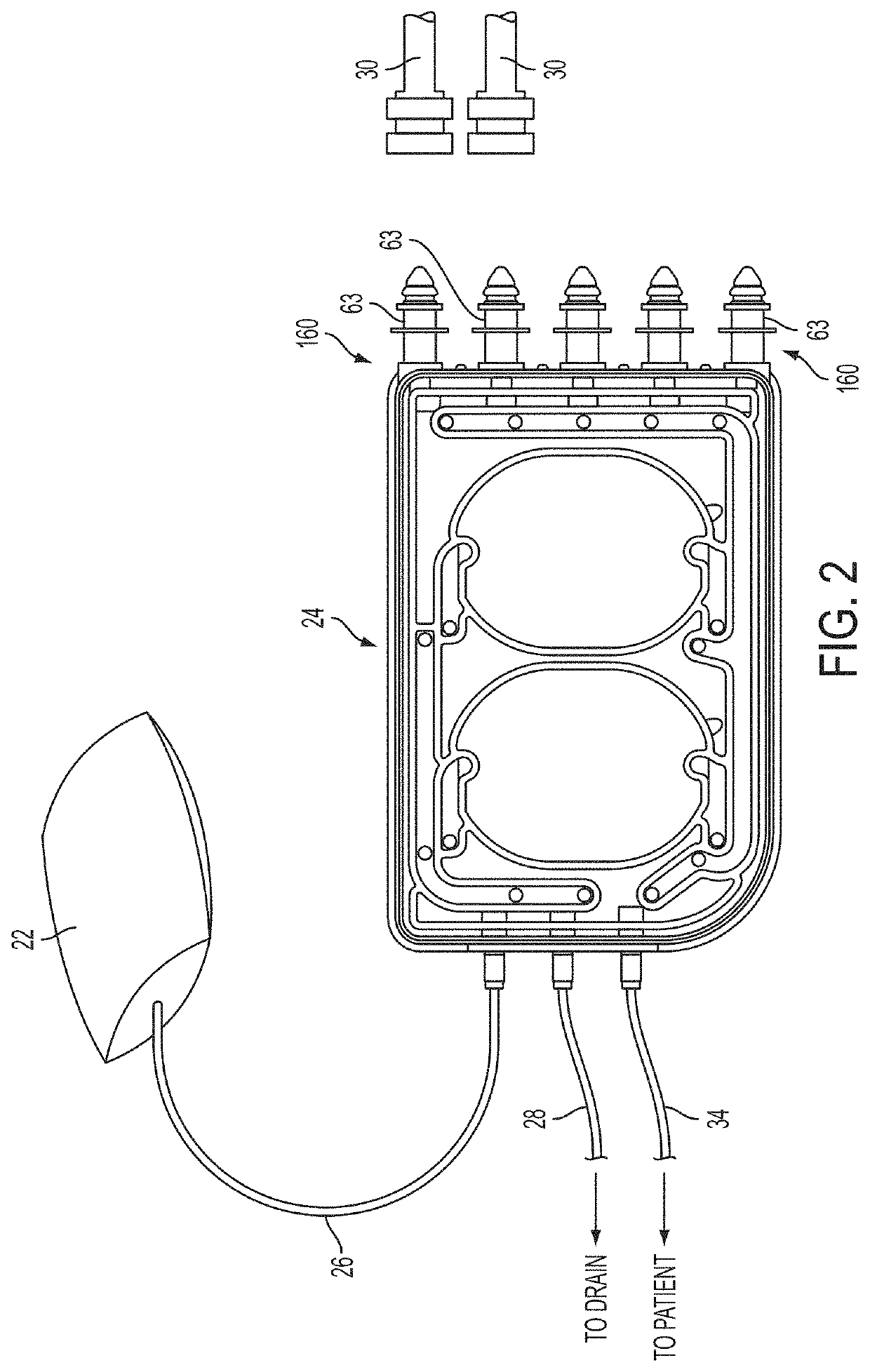 Medical treatment system and methods using a plurality of fluid lines