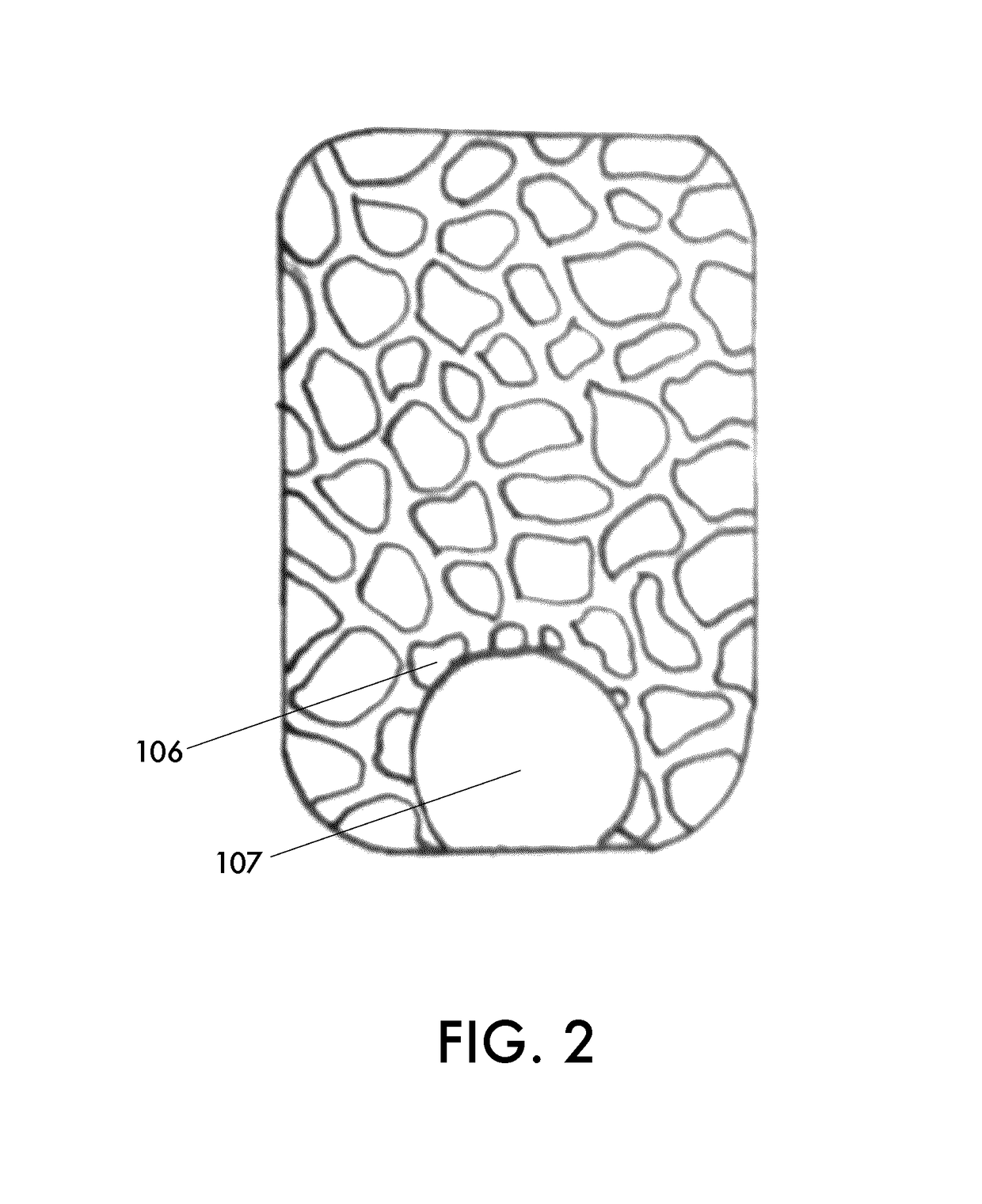 Orthopaedic brace and method for manufacturing an orthopaedic brace