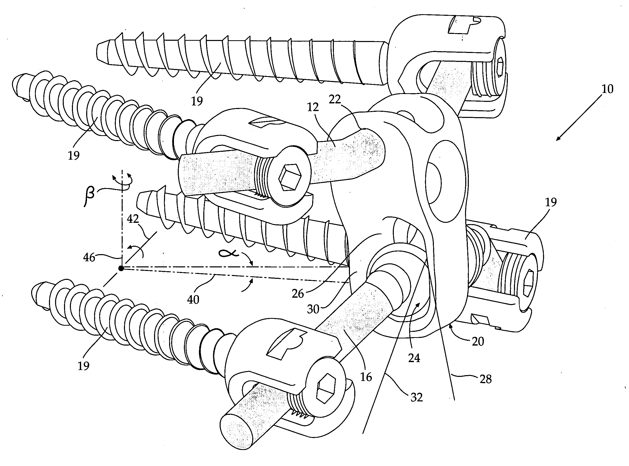 Spinal prosthesis