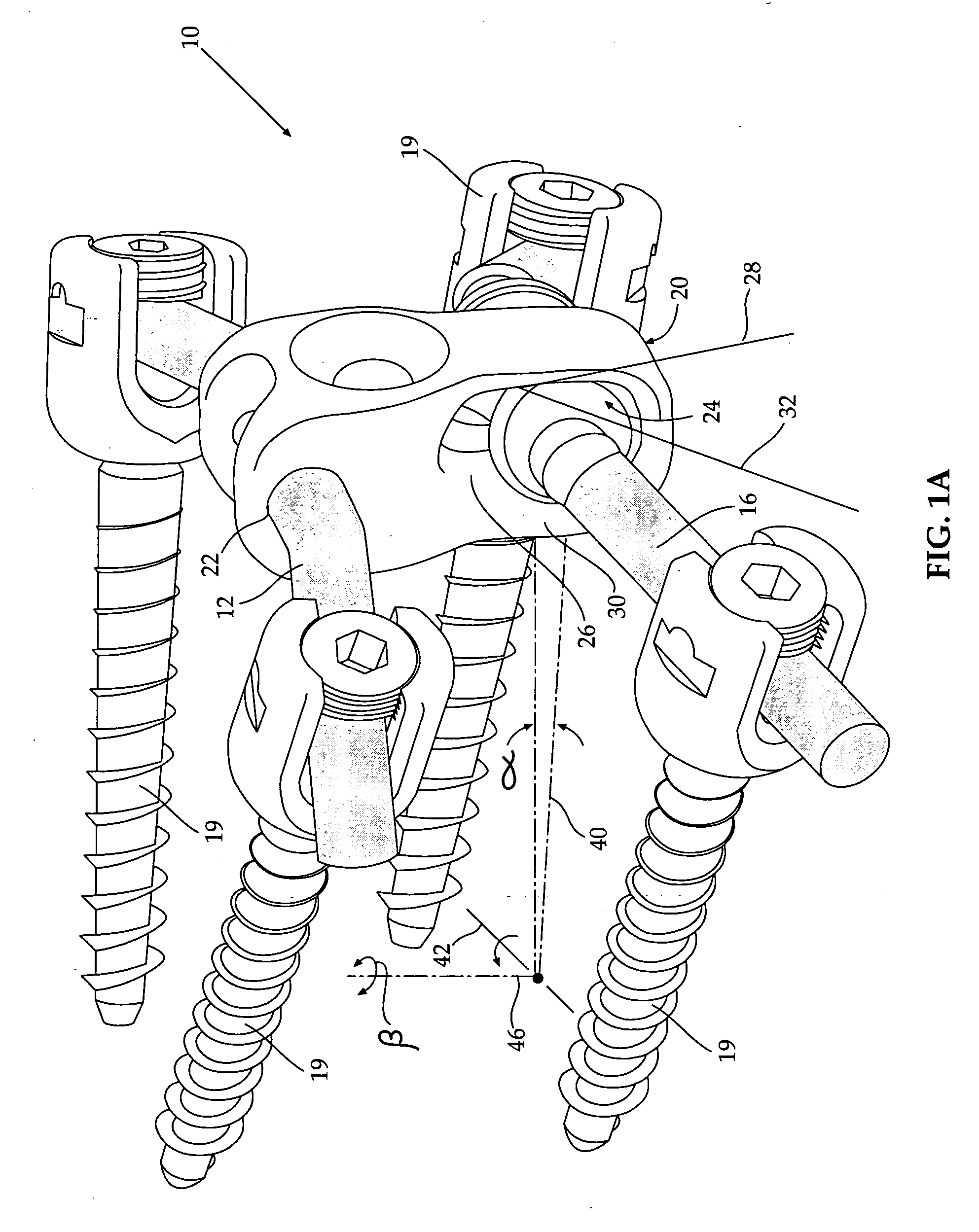 Spinal prosthesis