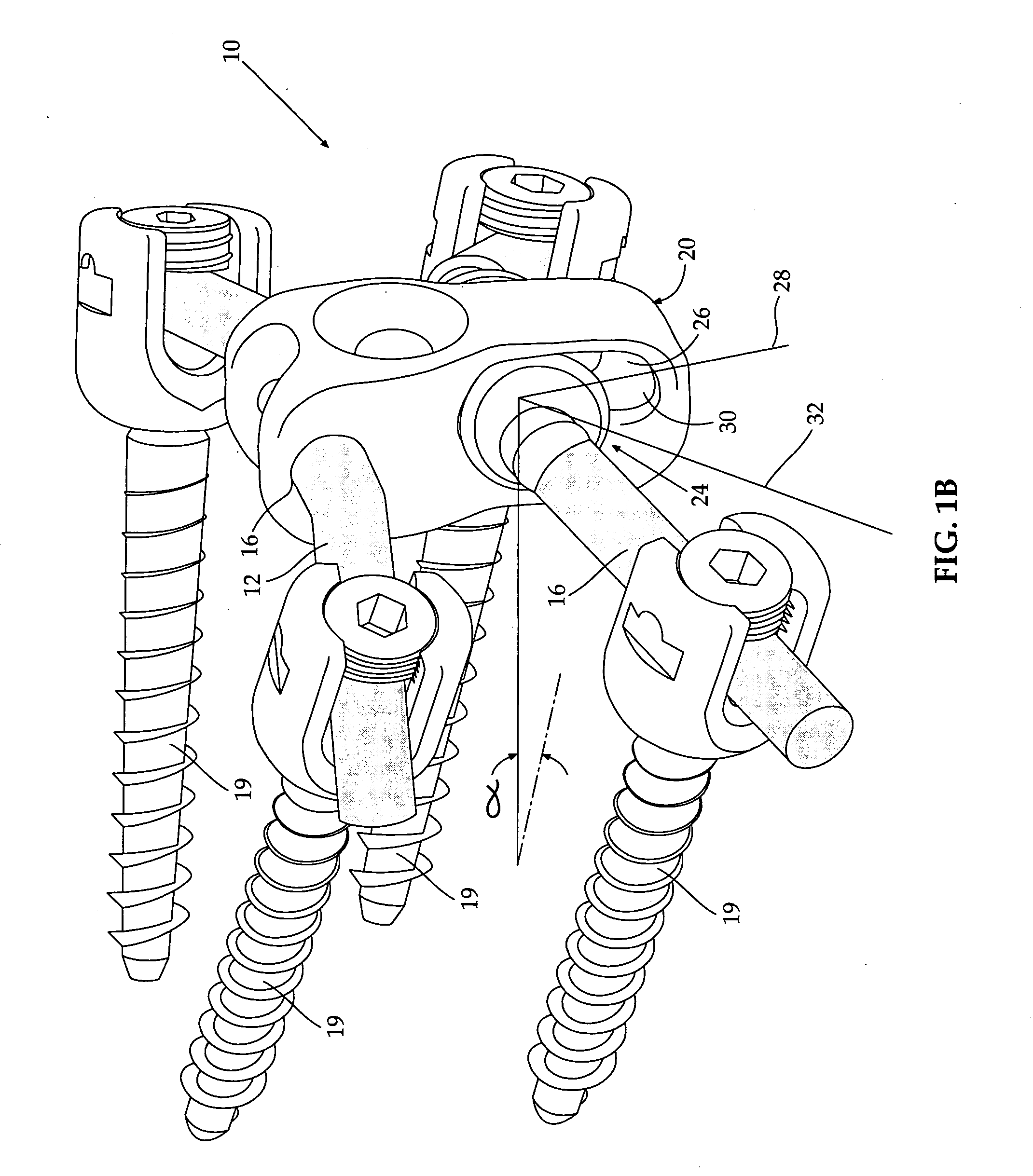 Spinal prosthesis