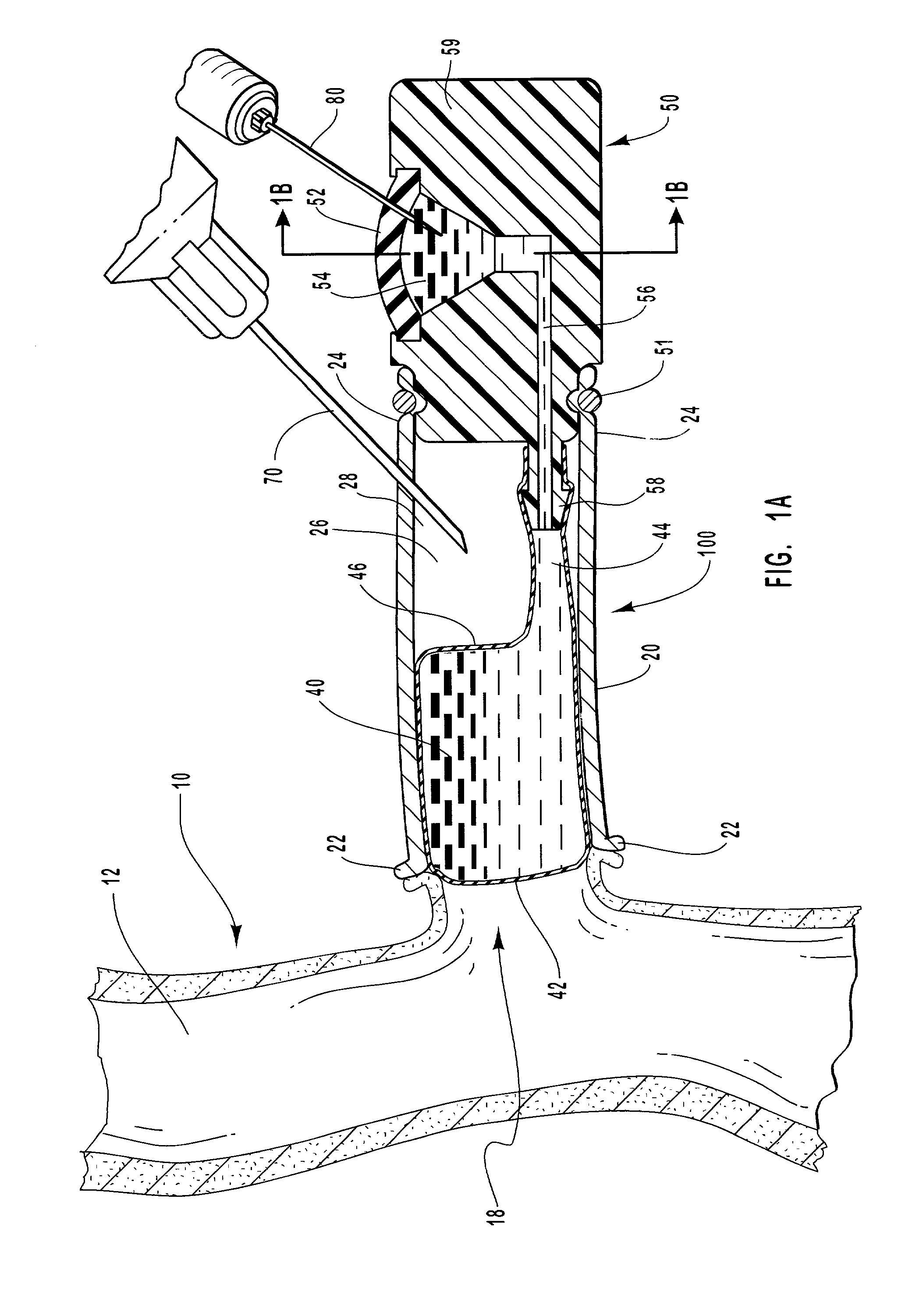 Vascular occlusal balloons and related vascular access devices and systems