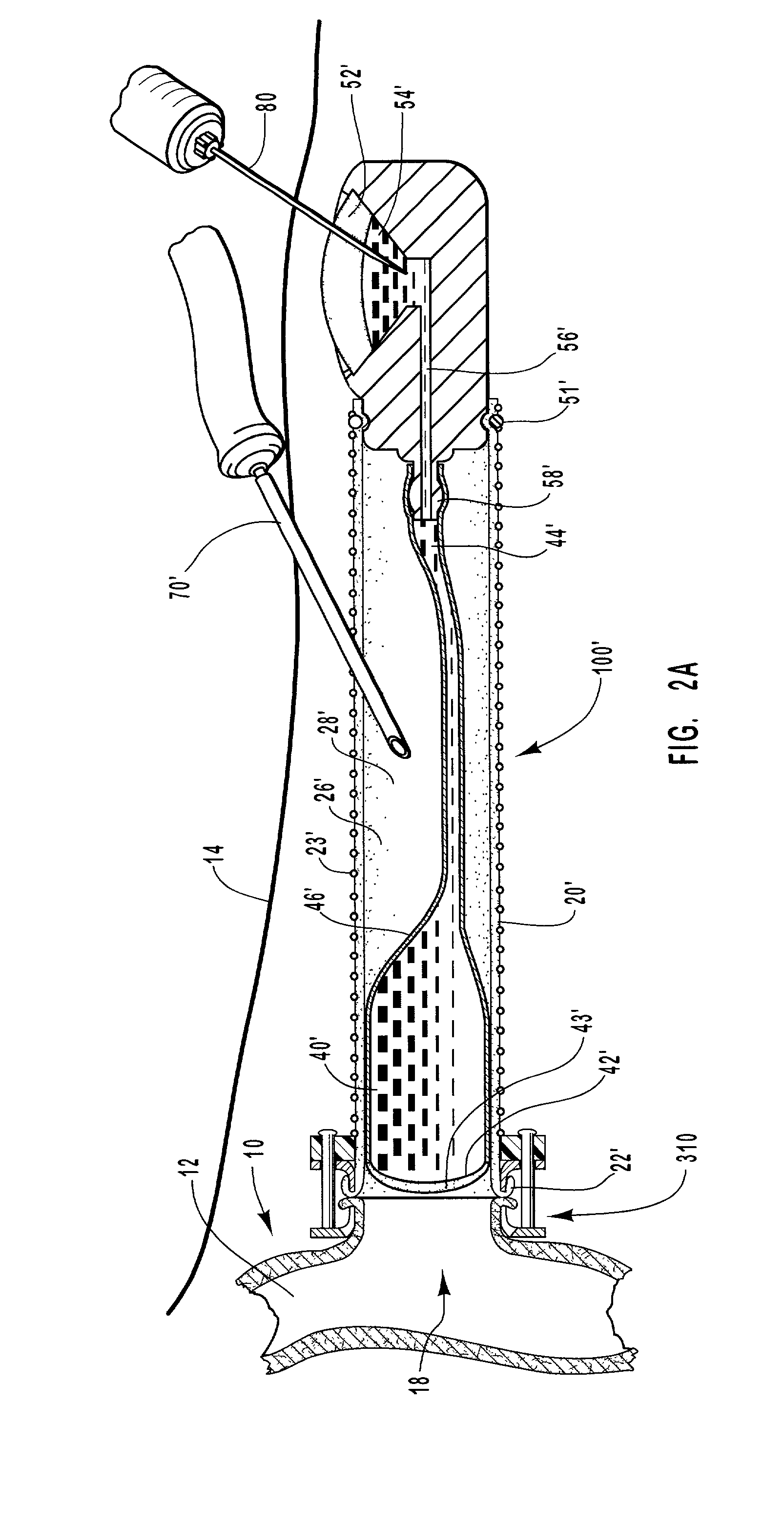 Vascular occlusal balloons and related vascular access devices and systems