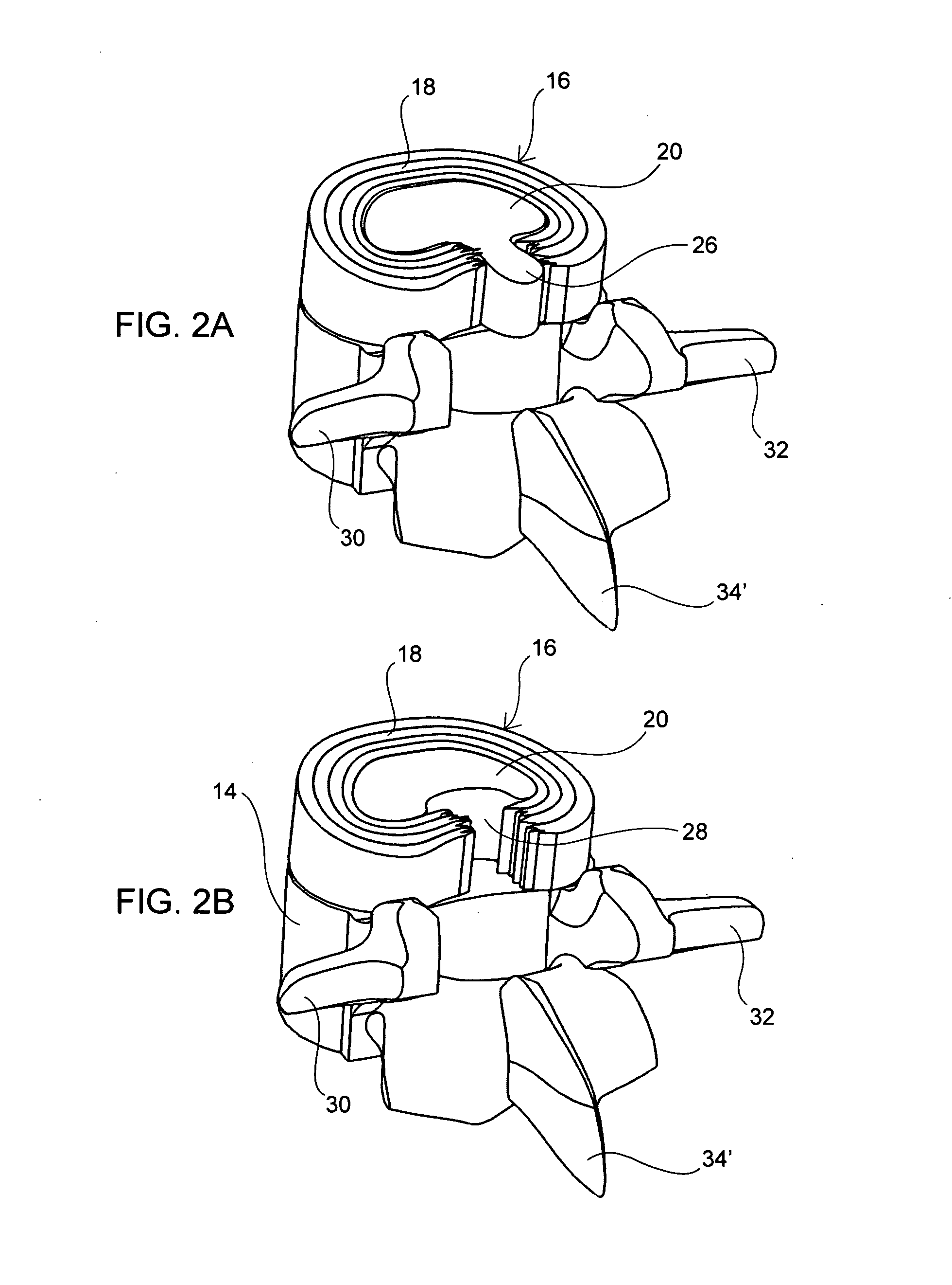 Devices, systems and methods for augmenting intervertebral discs