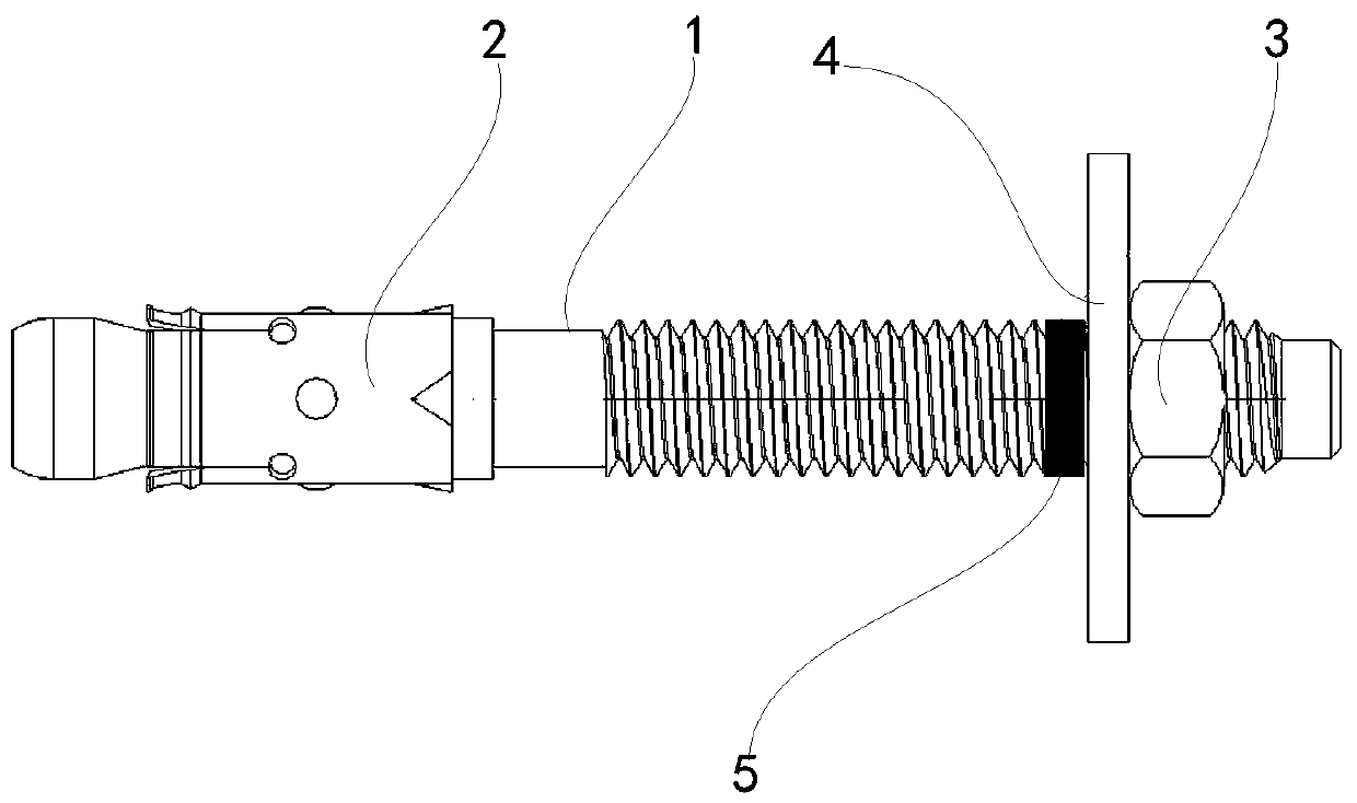 Novel self-undercut anchor