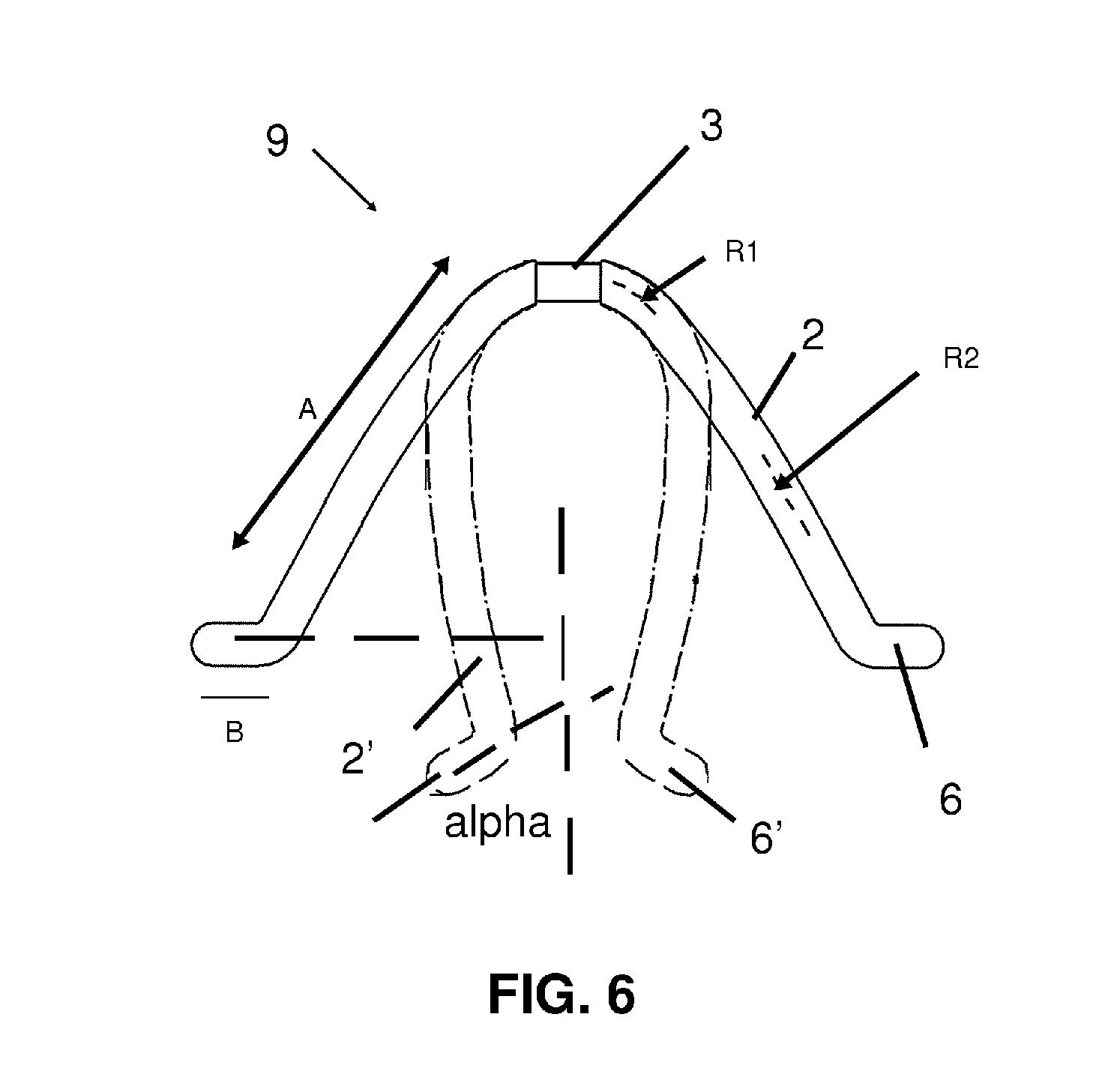 Plastic frame for an intrauterine device