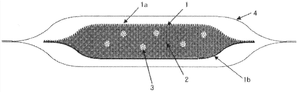 Nasal ventilation improvement device