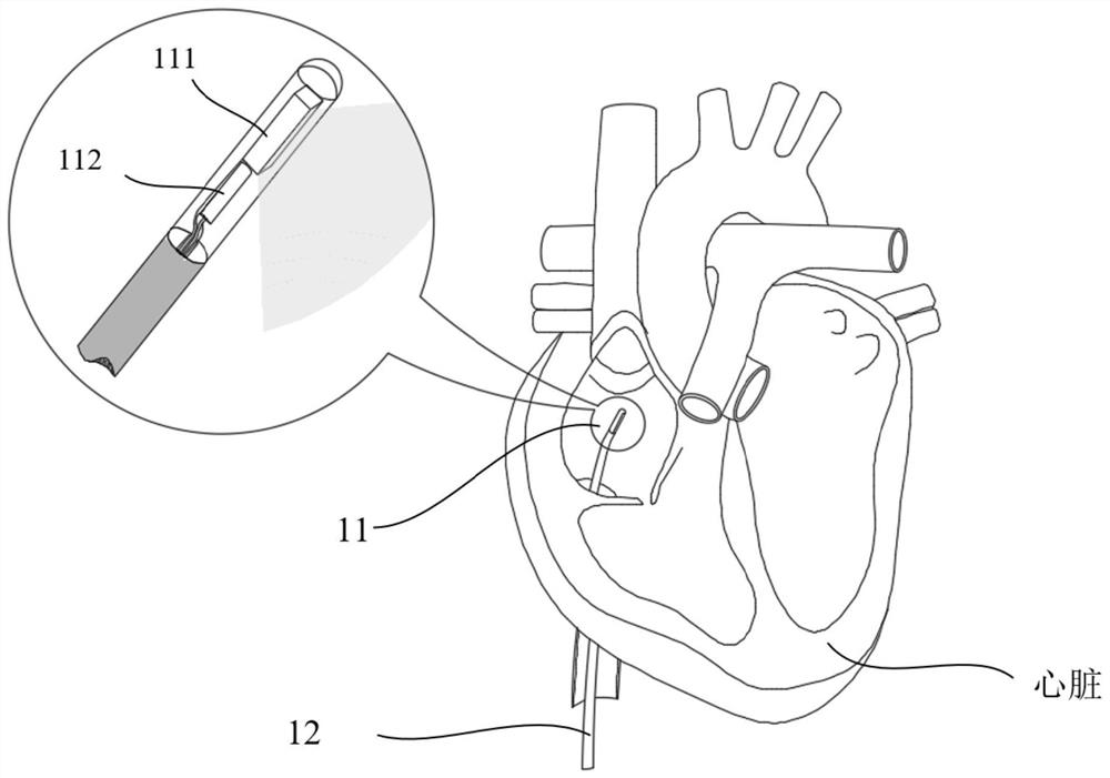 Method and system for measuring mechanical parameters of heart tissue