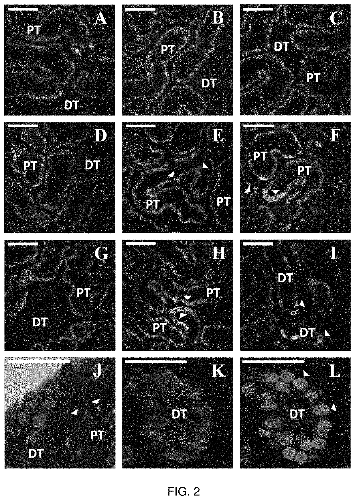 Hydrodynamic method and apparatus for delivering fluids to kidney tissues