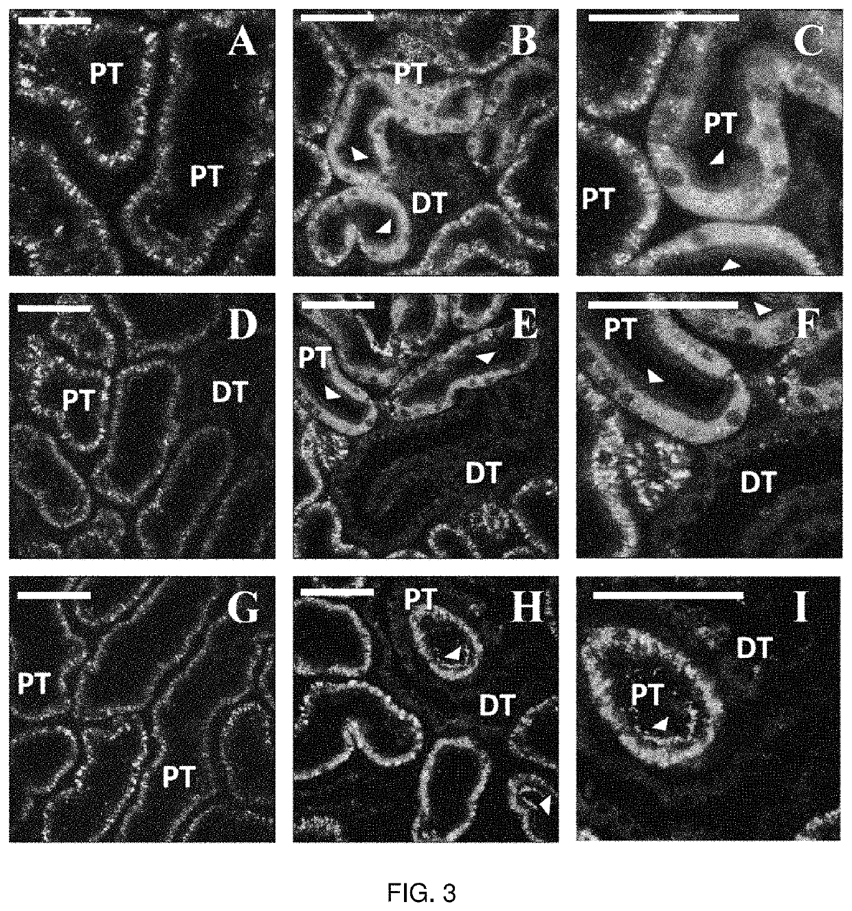 Hydrodynamic method and apparatus for delivering fluids to kidney tissues