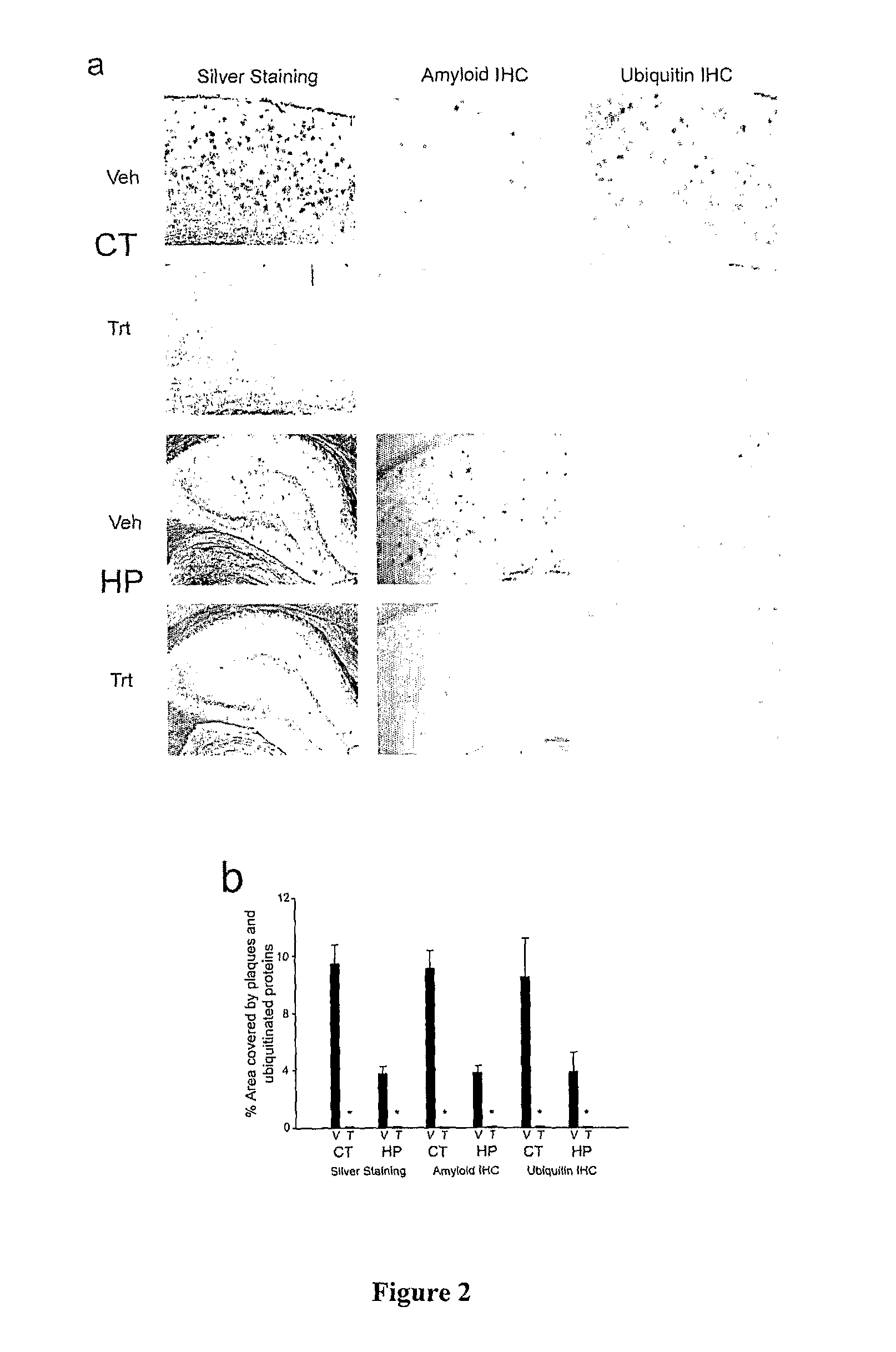 Withania somnifera plant extract and method of preparation thereof