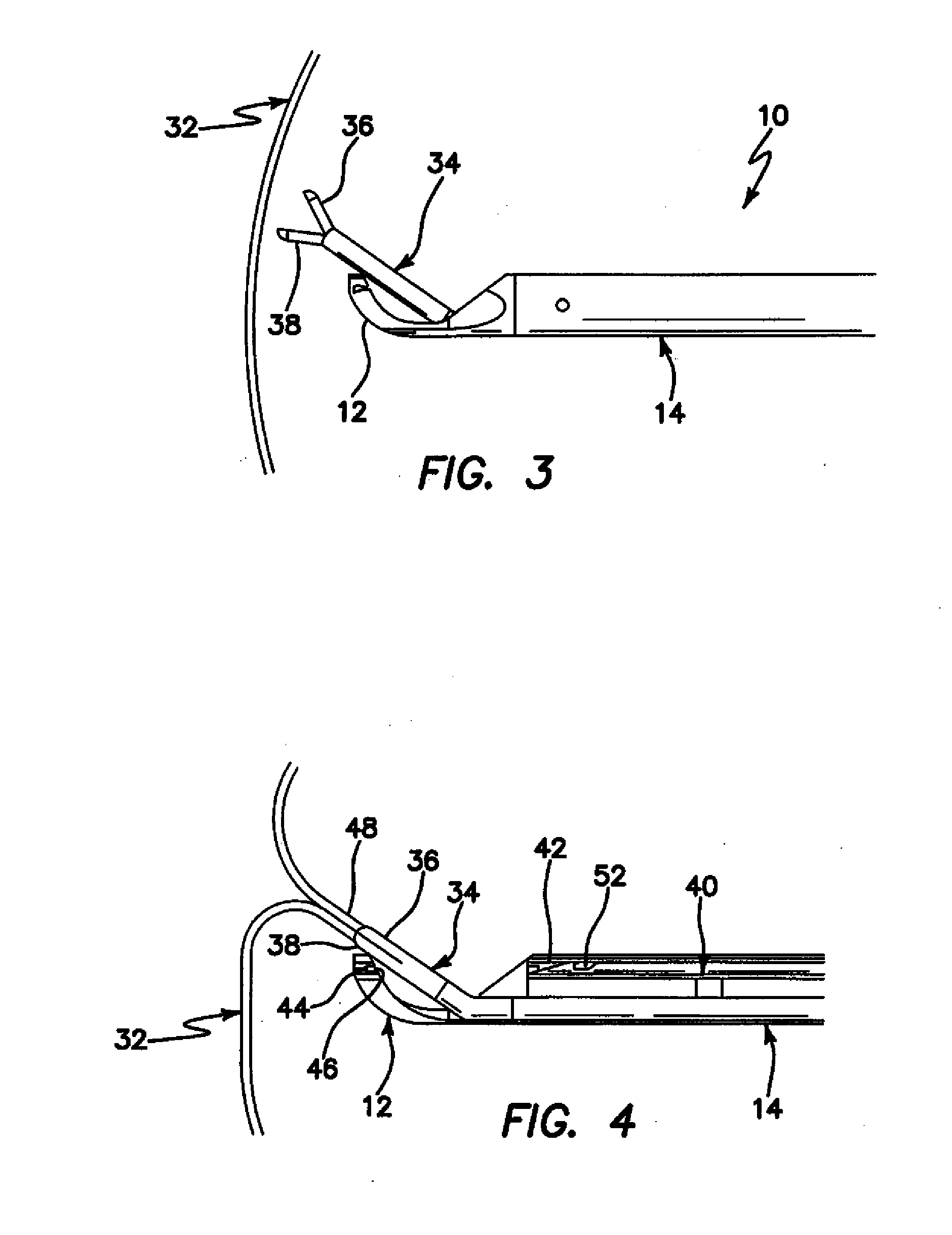 Arthroscopic soft tissue plication systems and methods