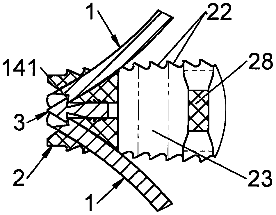 Anchoring device for a spinal implant, spinal implant and implantation instrumentation