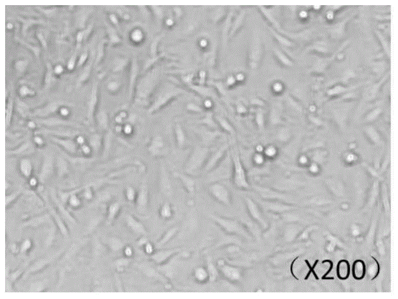 Triple-negative breast cancer cisplatin drug-resistance cell line, preparation method and uses thereof