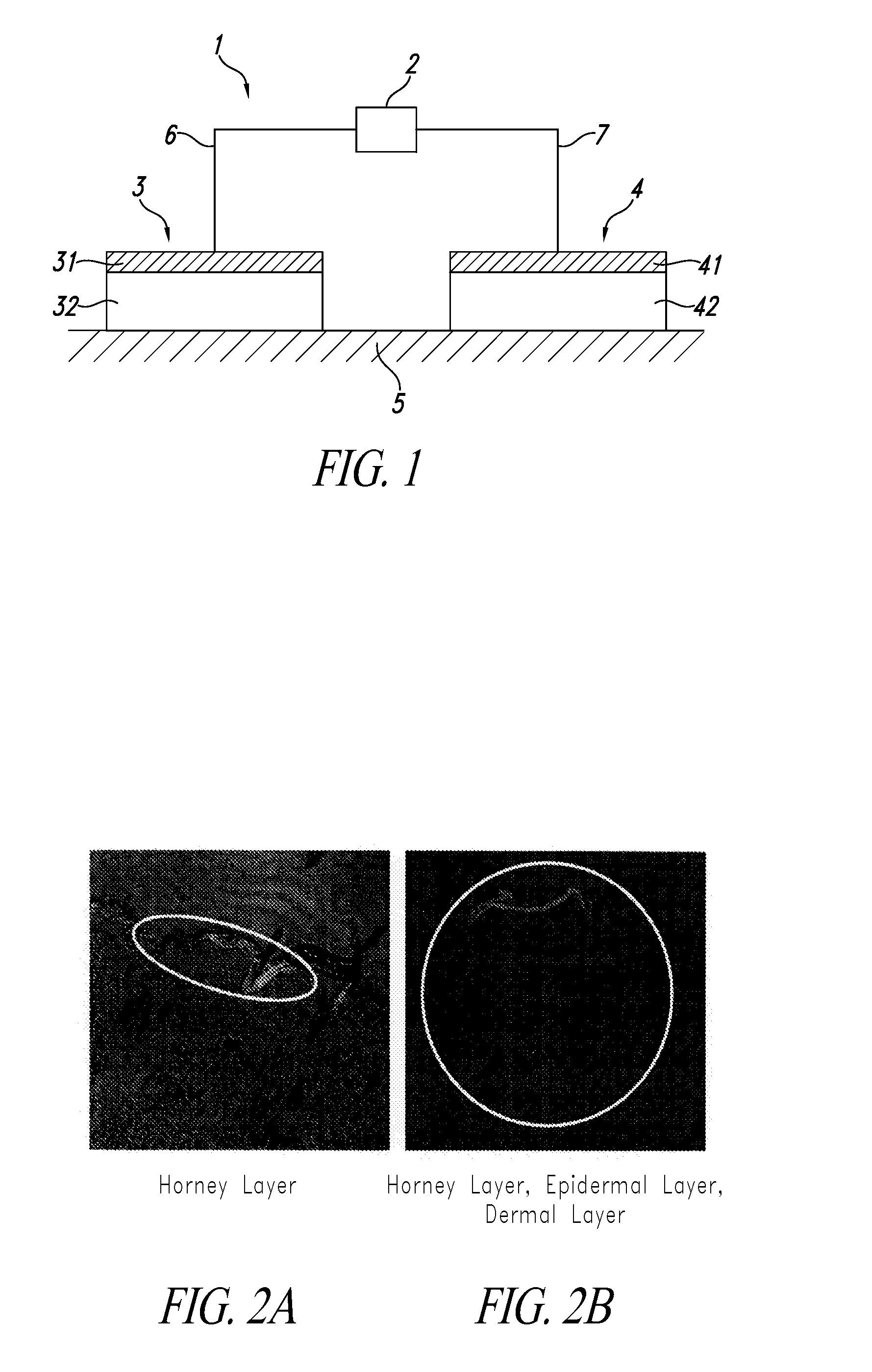 Composition comprising protein-liposome complex for iontophoresis