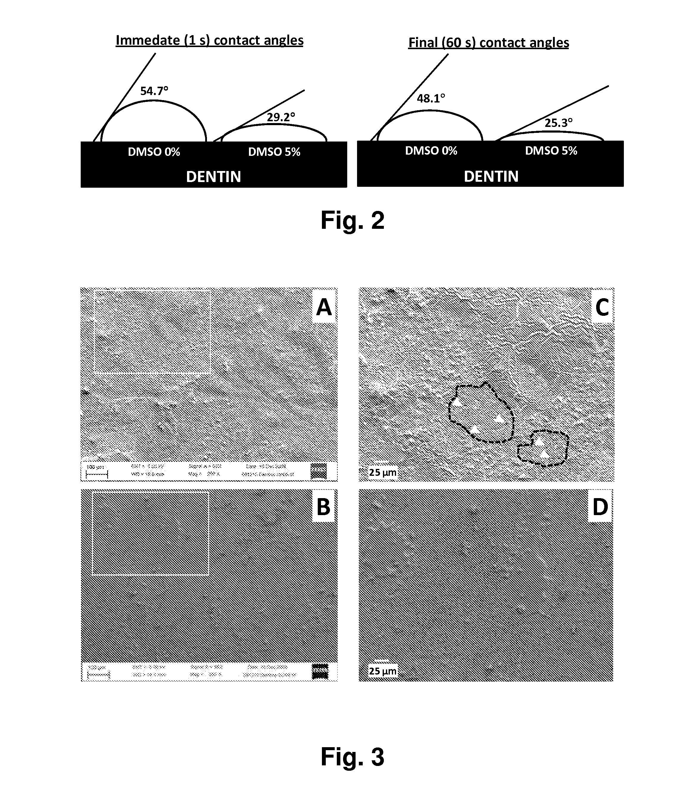 Method for Improving Penetration or Long Term Adhesion of Compositions to Dental Tissues and Compositions Usable in Said Method