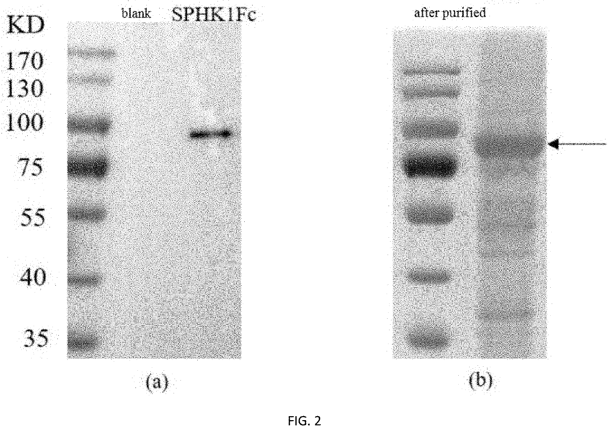 Sphingosine kinase 1 and fusion protein comprising the same and use thereof