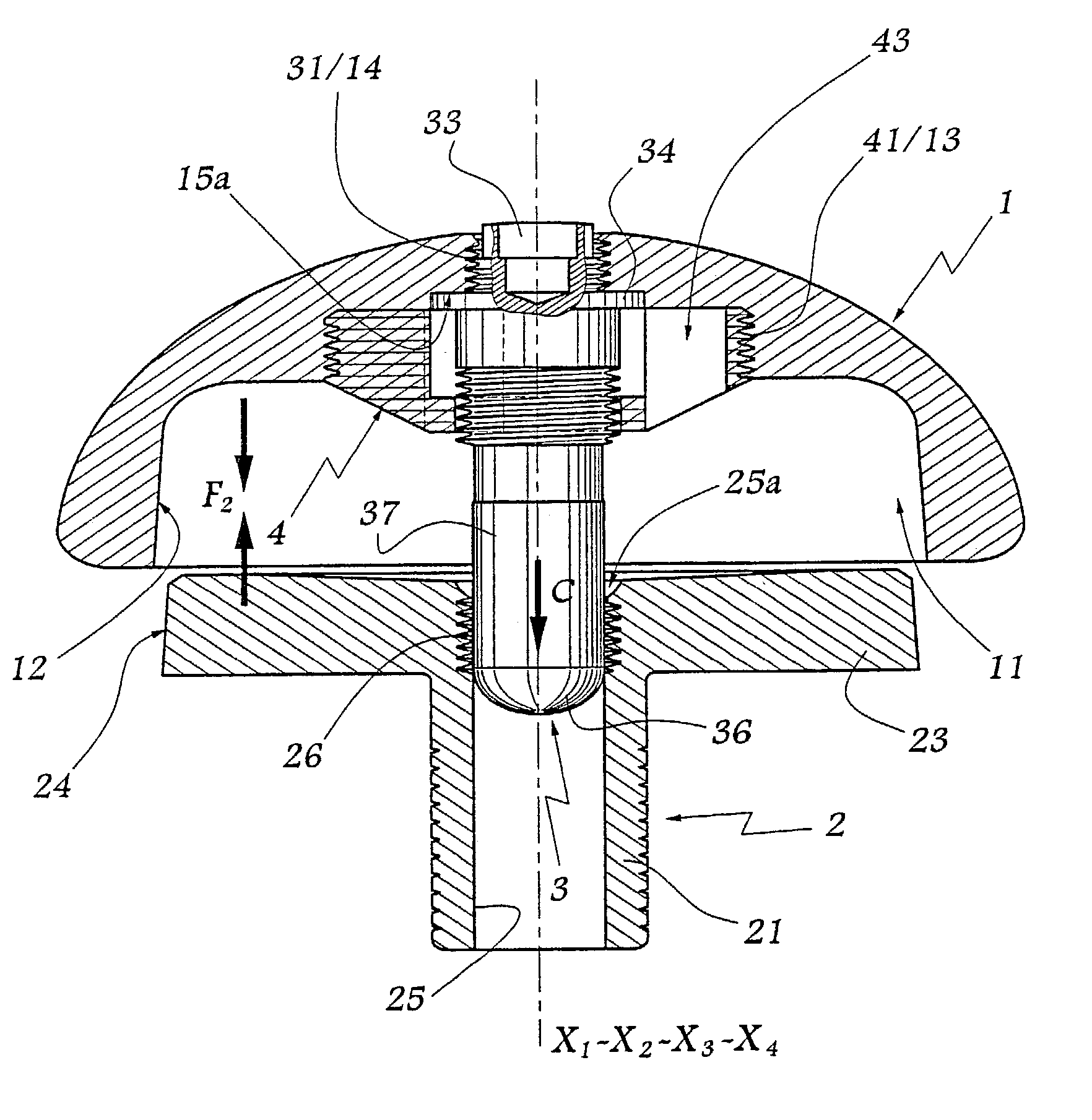 Prosthetic element comprising two components and process for assembling such a prosthetic element