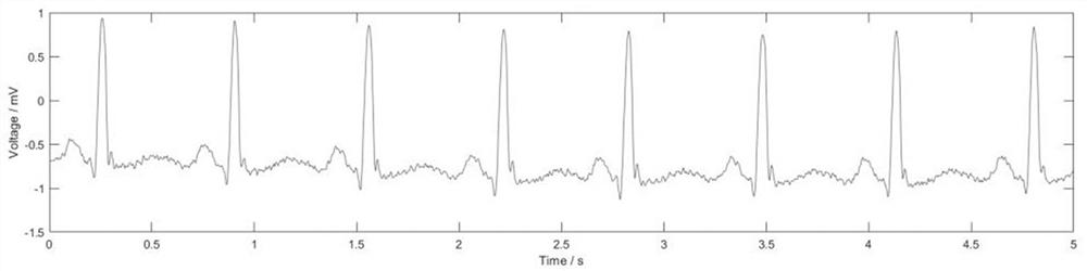 An ECG Signal Denoising Algorithm Based on New Threshold Function Wavelet Transform