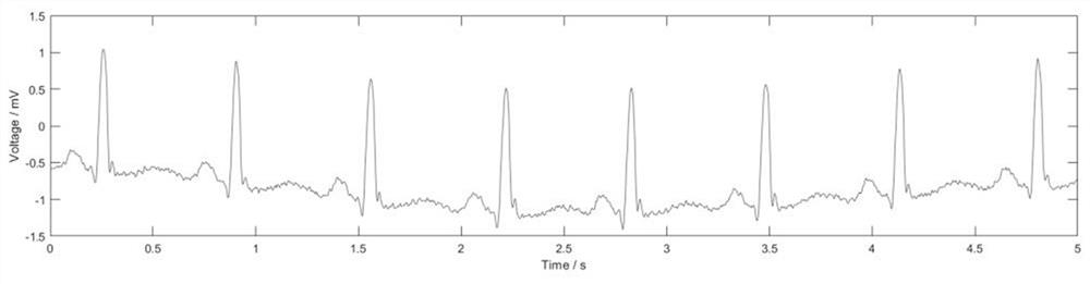 An ECG Signal Denoising Algorithm Based on New Threshold Function Wavelet Transform