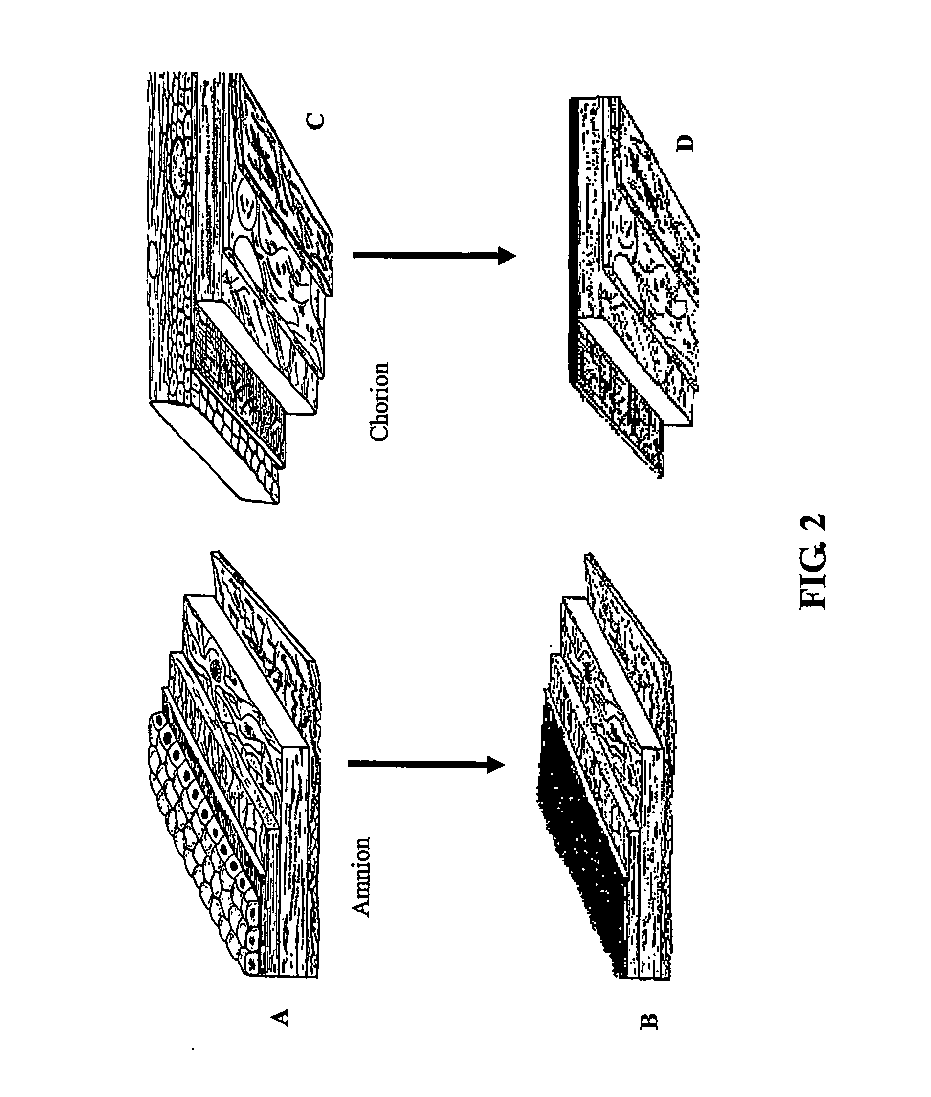Methods of preparing transplantable product for treatment of skin defects