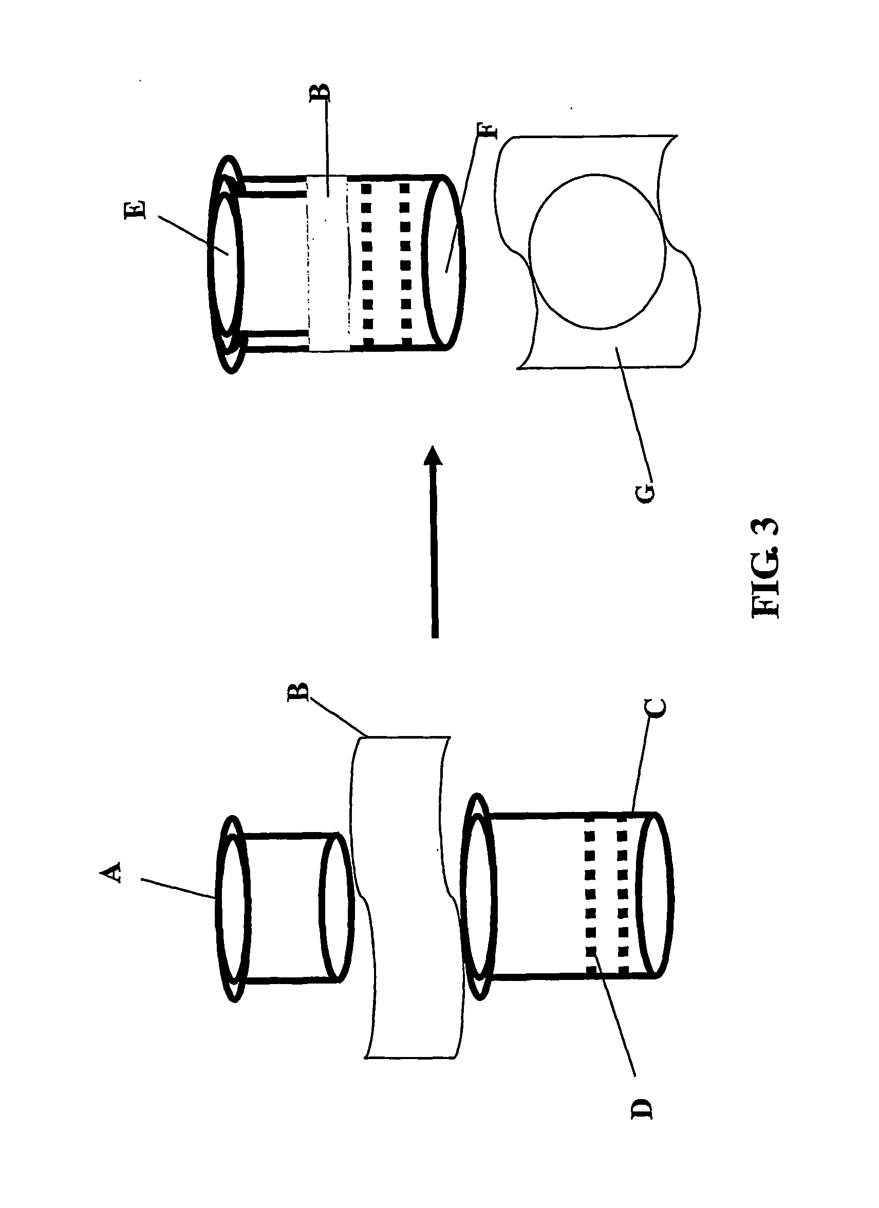 Methods of preparing transplantable product for treatment of skin defects