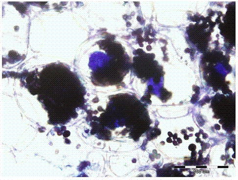 Method for simultaneously dyeing mycelial masses and starch in mycorhiza of arethusa