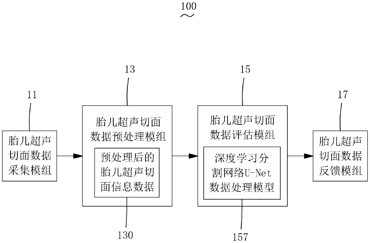 Automatic quality control system and detection method of fetal ultrasonic section image