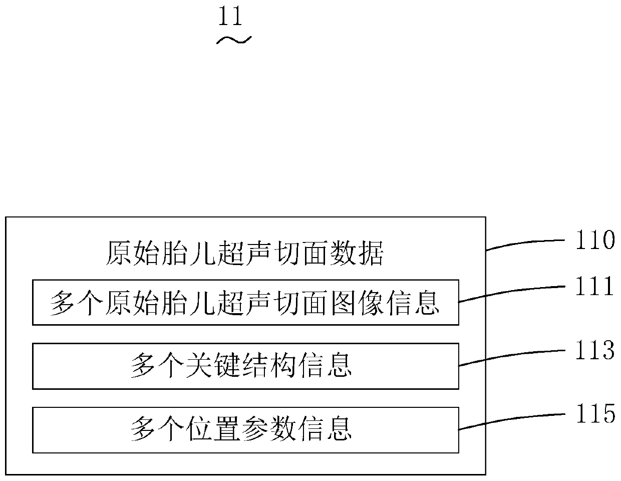 Automatic quality control system and detection method of fetal ultrasonic section image