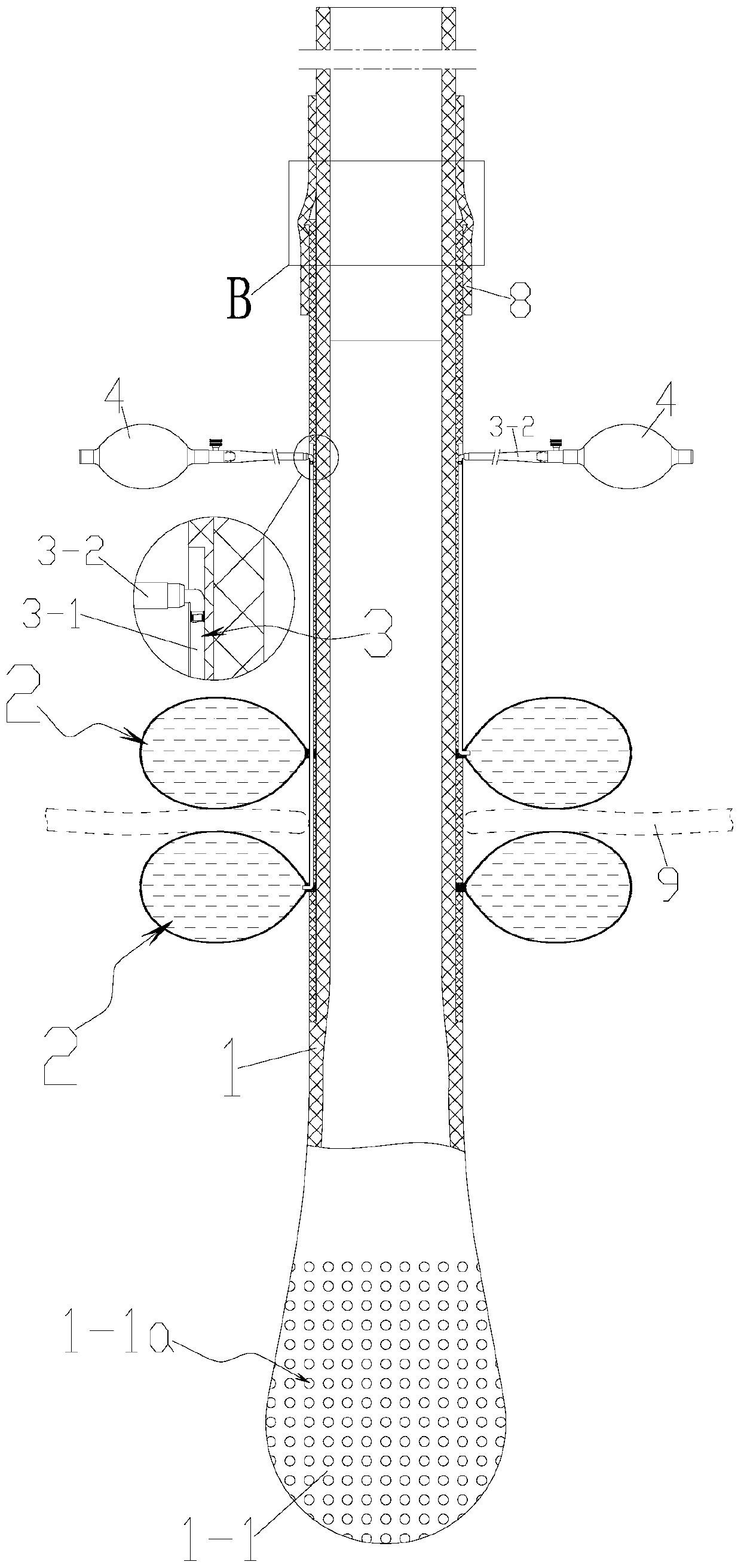 abdominal drainage tube