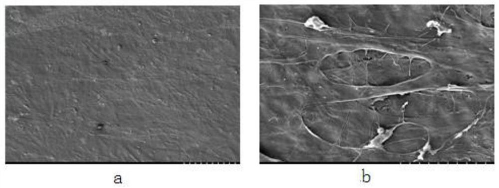 A method and application of constructing adipose stem cell membrane