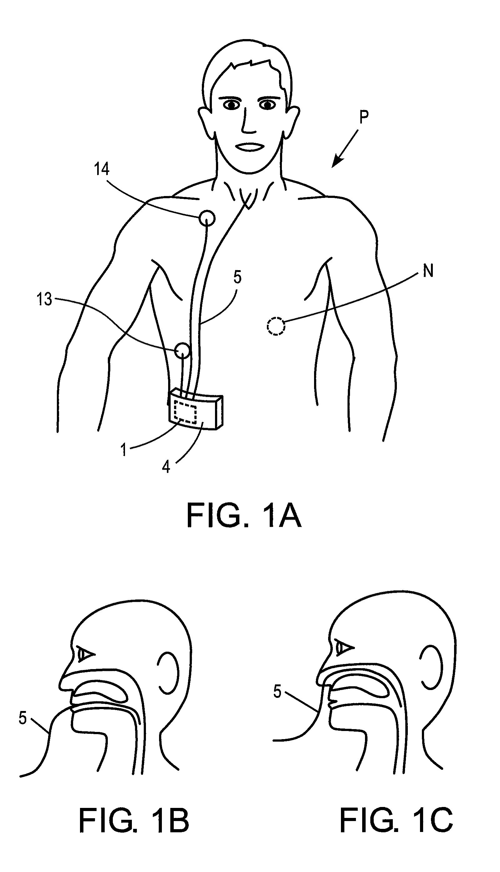Systems, methods and apparatus for respiratory support of a patient
