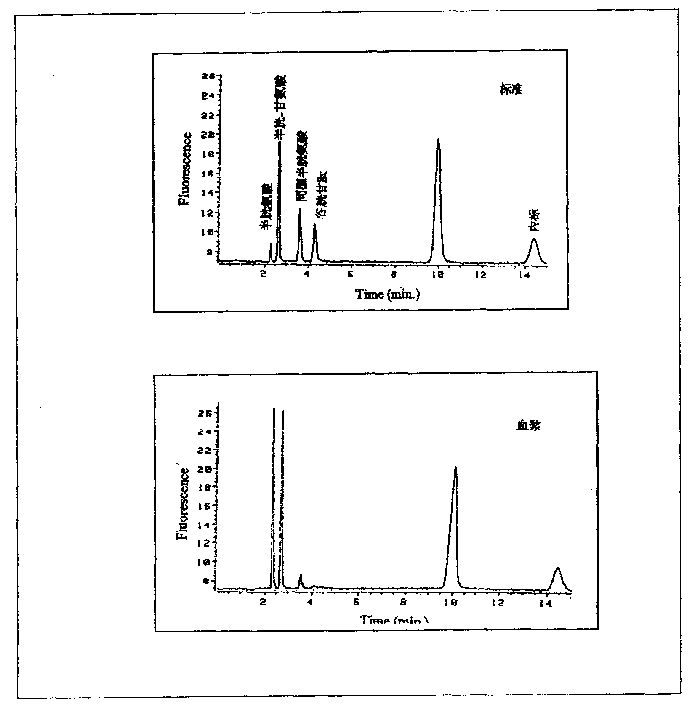 Fluorescent analysis reagent for testing blood homo cysteine, method for preparing same and use thereof