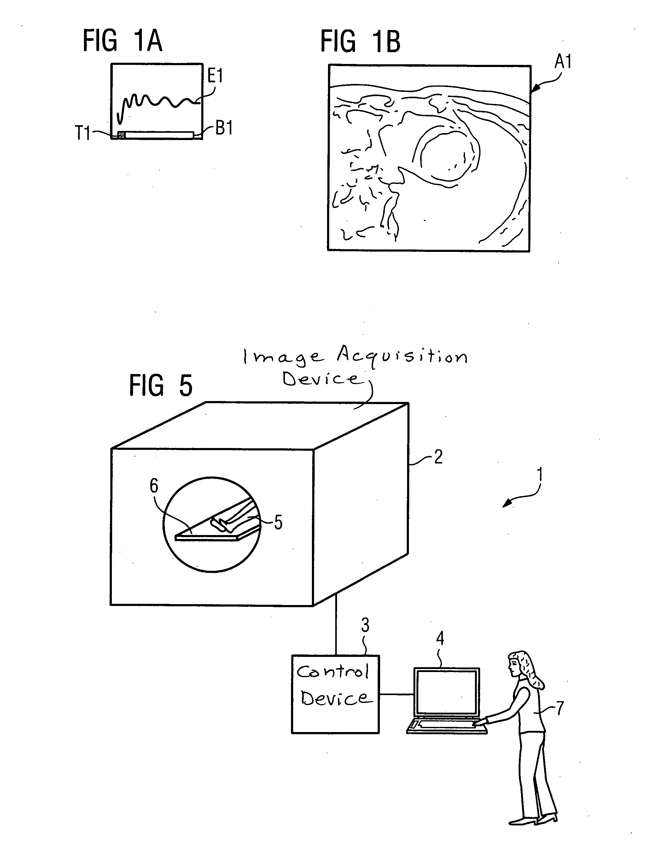 Method for generating an image exposure of the heart requiring a preparation