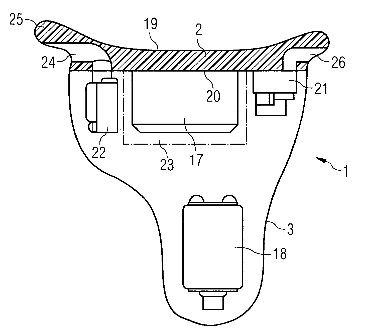 Hearing device with a contact unit and an associated external unit